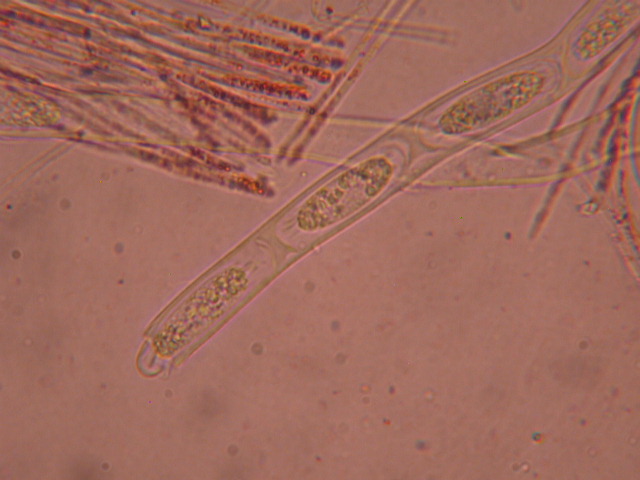 Sarcoscypha jurana... al microscopio